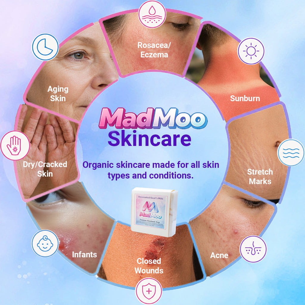 MadMoo’s Premium Handmade Artisan Soap Bar
